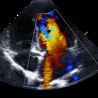 Diploma in Echocardiography
